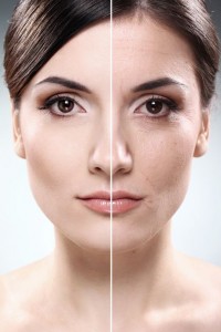 womans-face-wrinkles-before-after